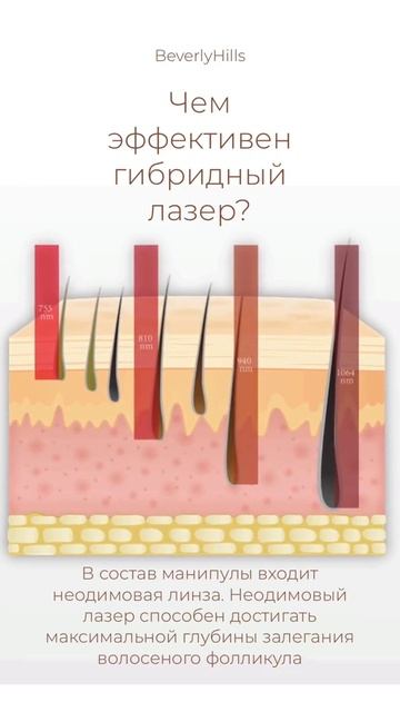 Эффективность гибридного лазера смотреть онлайн