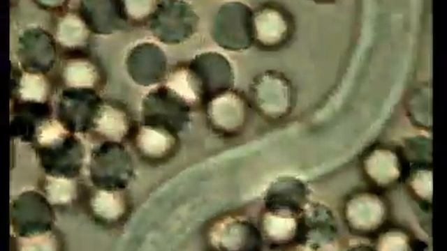 Canine Heartworm Disease смотреть онлайн