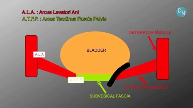 OPUR (ОПЮР) - Коррекция пролапса