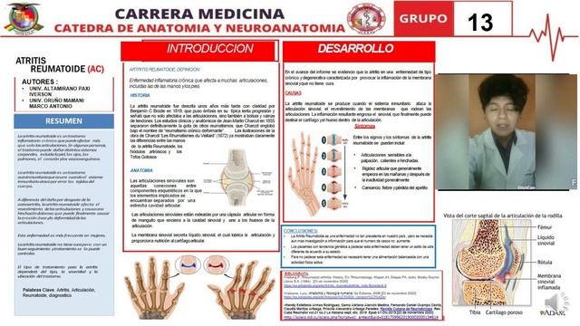 E-poster ARTRITIS REUMATOIDE смотреть онлайн