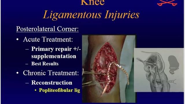 Miller's Orthopaedic Lectures: Sports 1 смотреть онлайн