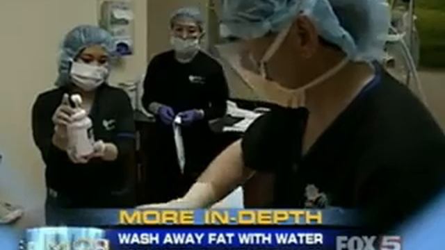 Laserlipoguide - Body Jet Liposuction смотреть онлайн