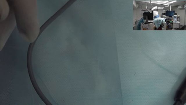 Атлантоаксиальная нестабильность смотреть онлайн