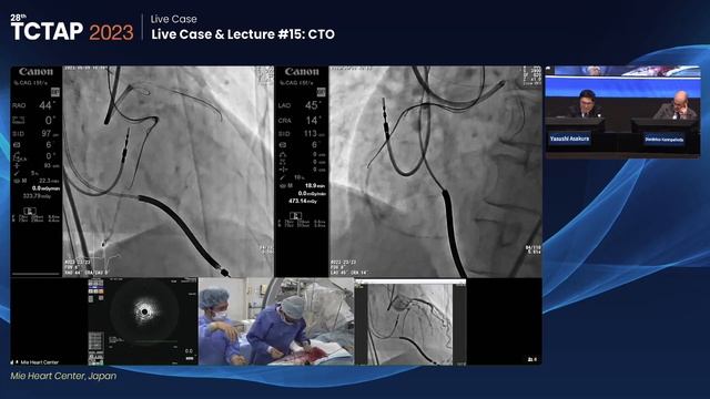 [TCTAP 2023] Live Case & Lecture #15: CTO смотреть онлайн