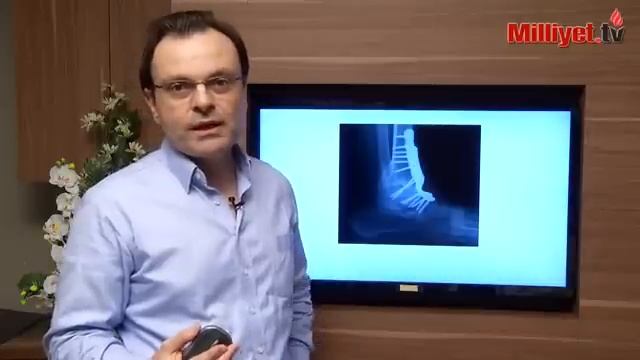 Ayak Bileği Kireçlenmesi | Prof. Dr. Tahir Öğüt смотреть онлайн