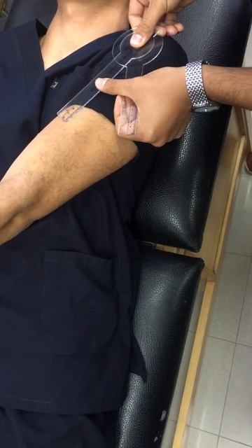 Evaluation - shoulder adduction ( geometer ) смотреть онлайн