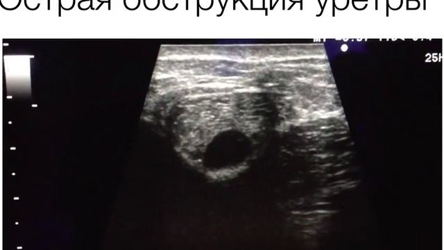 предстательная железа  уретра матка