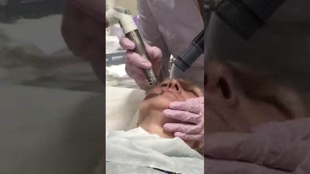 Smooth laser photona часть 1 смотреть онлайн