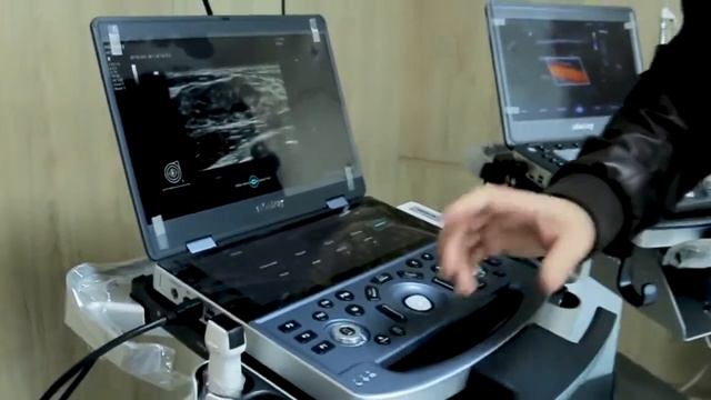 Ultrasonidos Mindray Portátiles - Gama M смотреть онлайн