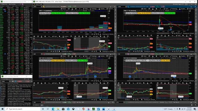 BBIG Stock and Other Hot Picks | Technical Analysis on the charts for next weeks outlook. смотреть онлайн