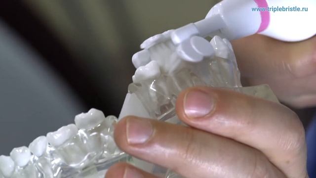 Triple Bristle Original: демонстрация на зубной модели смотреть онлайн