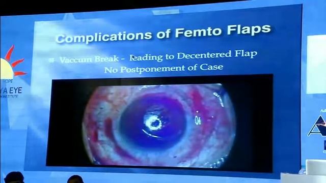 ACReS2018, FEMTOSECOND vs KERATOME FLAPS смотреть онлайн