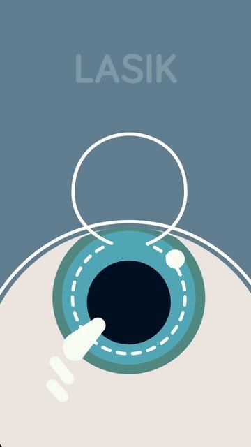 How Does Laser Eye Surgery Actually Work смотреть онлайн