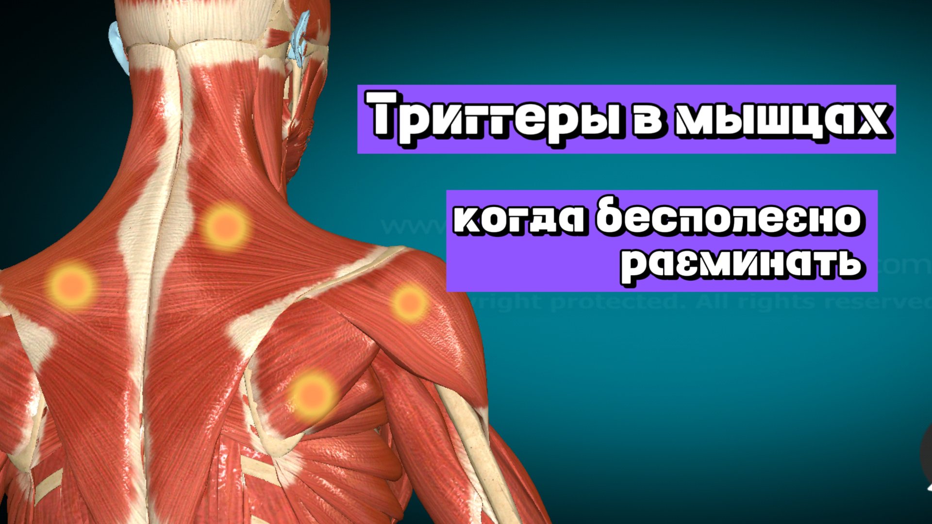 Про триггерные точки