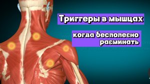 Про триггерные точки