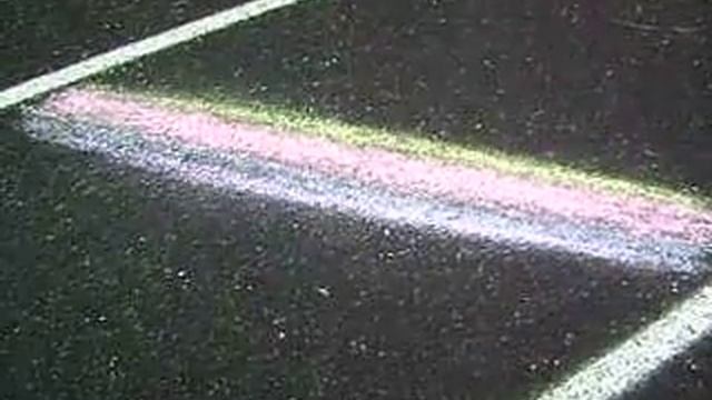 "Pathophysiology", Magnetic Resonance Imaging (MRI) смотреть онлайн