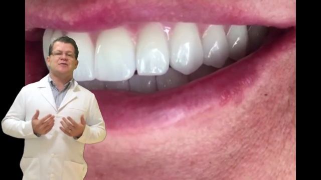 Carga Imediata com Implantes Grand Morse Neodent e Dentes em Zirconia. Porto Alegre смотреть онлайн