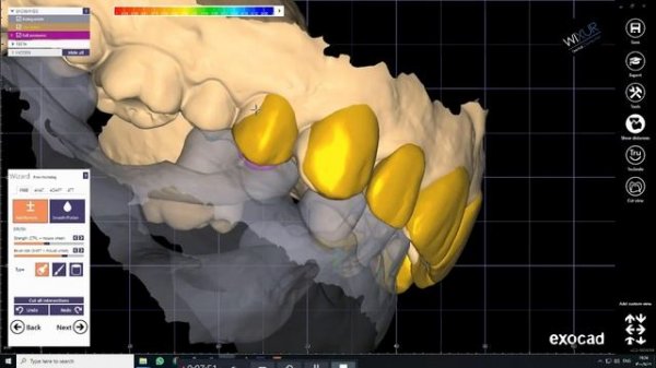 Exocad - Smile Creator