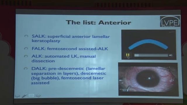 AIOC2017 - Sub Speciality Capsules - Cornea Society of India (18.02.2017 / 08:00-08:55 / HALL: B ) смотреть онлайн