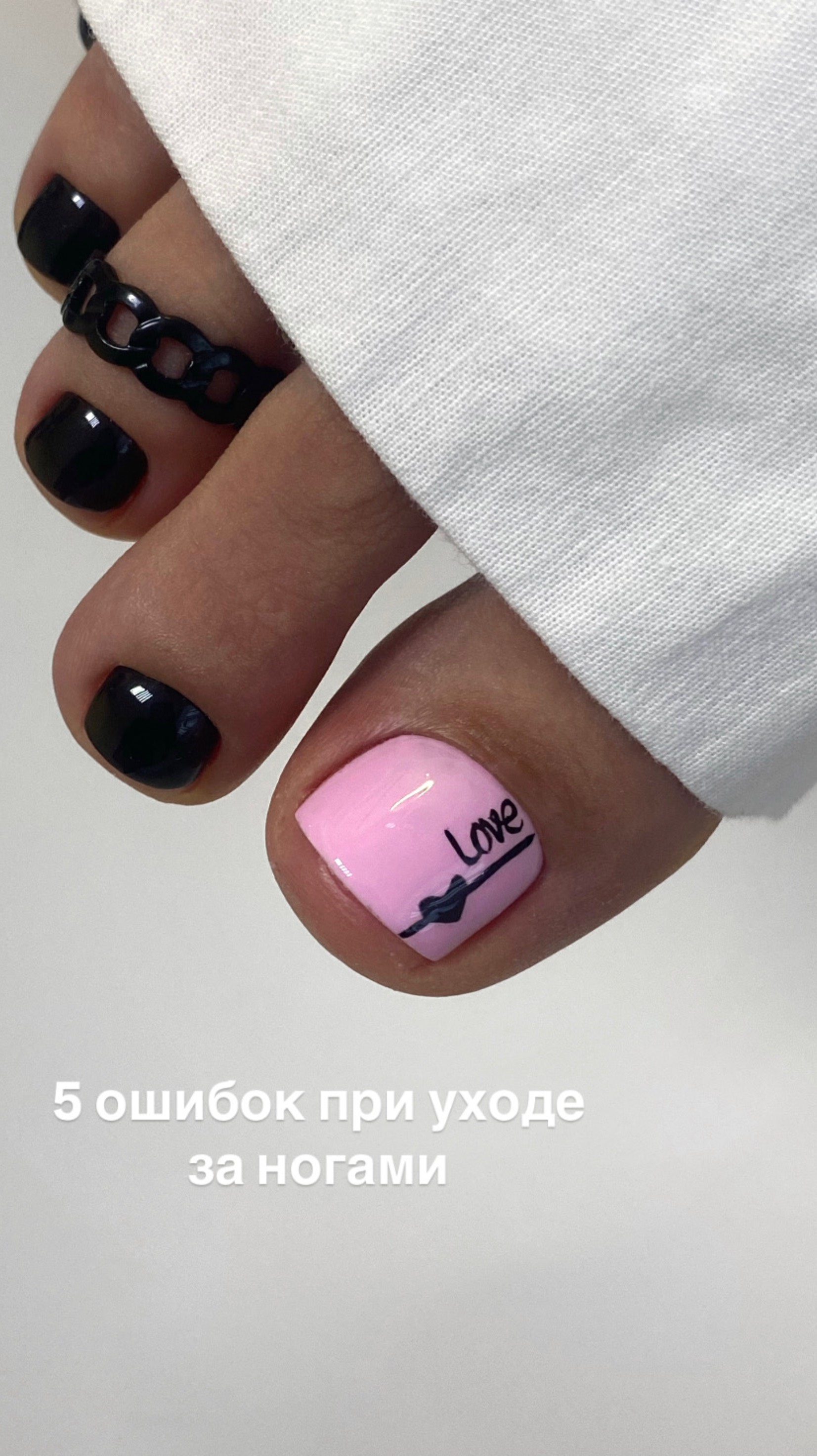 ПЛОХОЙ УХОД ЗА НОГАМИ😱🤢😬