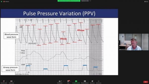The management of an infant with septic shock,