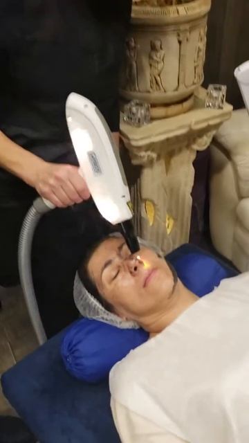 Лазерный карбоновый пилинг для лица на Gelios смотреть онлайн