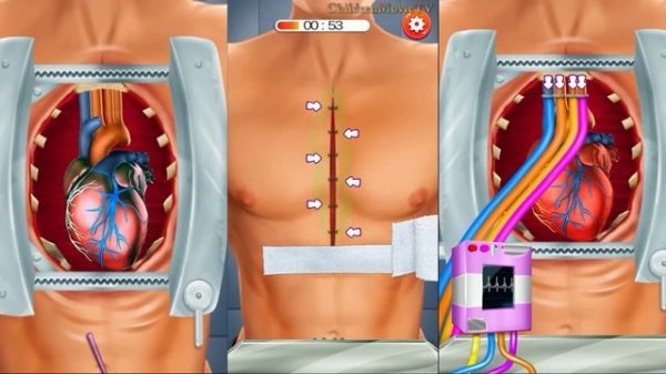 ER Emergency Heart Surgery - Kids Doctor Games - Heart Surgery Simulator Games Android/iOs