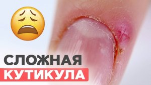 Чистый аппаратный маникюр при опасной кутикуле | МАКРО