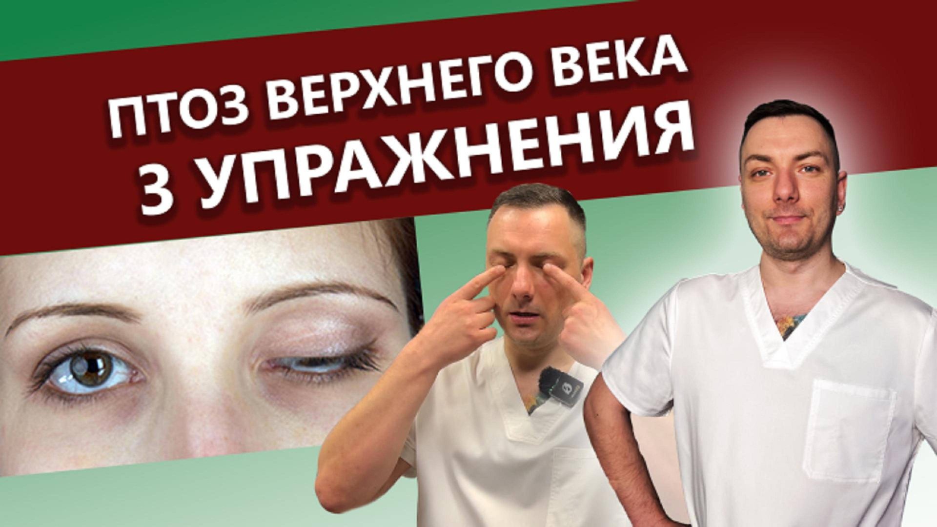 Упражнения от птоза верхнего века / Что такое птоз / Как убрать птоз / опущение верхнего века смотреть онлайн