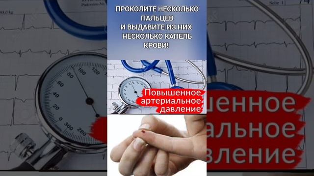 Предотврати инсульт! Помоги себе сам! Советы от Ольги Николаевны Романенко! смотреть онлайн