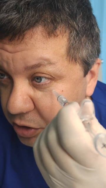 Как убрать западение под глазами? смотреть онлайн