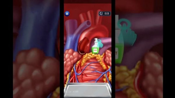 Doctor Surgery Gameplay | Heart surgery animation game | Android games walkthrough | Smile ASMR