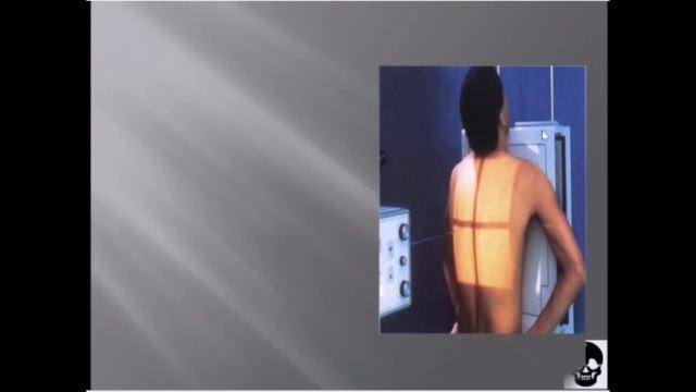 Chest X-ray (PA Projection) смотреть онлайн