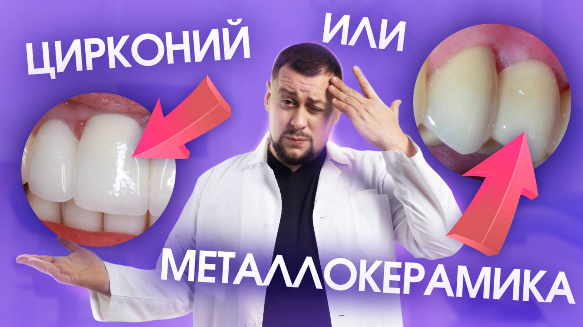 Цирконий или металлокерамика? Что выбрать?