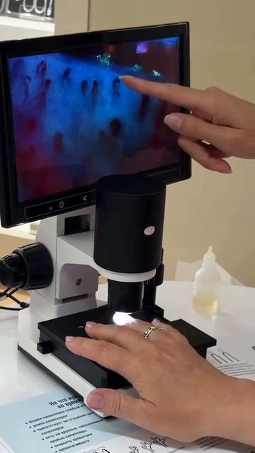 Капилляроскопия- быстрая диагностика вашего организма