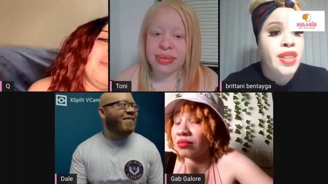 ALBINISM AWARENESS DAY SPECIAL PART 1 | EPISODE 21 LIFE WITH ALBINISM PODCAST смотреть онлайн