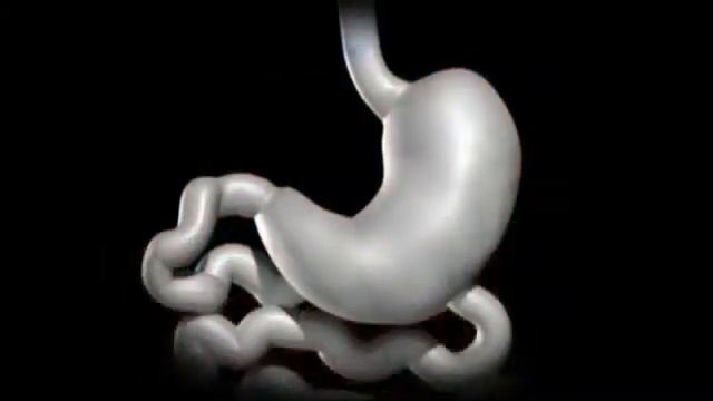 Senior Segment: Dr. Peel discusses Metabolic Weight Loss Surgery Institute смотреть онлайн