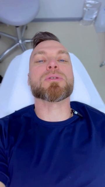 Фотоэпиляция бороды на Lumenis M22 смотреть онлайн