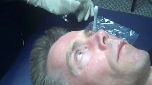 AQ Skin Solutions Derma Stamp Facial procedure - YouTube.flv смотреть онлайн