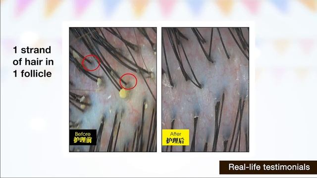 Fix Your Hair & Scalp Problems with Our Customised Protein Treatments | Jonsson Protein смотреть онлайн