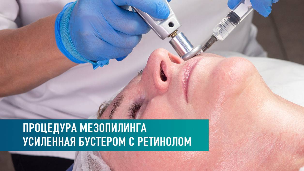 Процедура мезопилинга усиленная бустером с ретинолом смотреть онлайн
