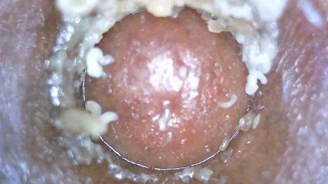 PORE VACUUM | 6 MINUTES смотреть онлайн