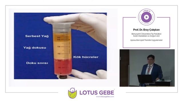 Prof. Dr. Eray Çalışkan - Liposuction Lipid Transferi Uygulamaları смотреть онлайн