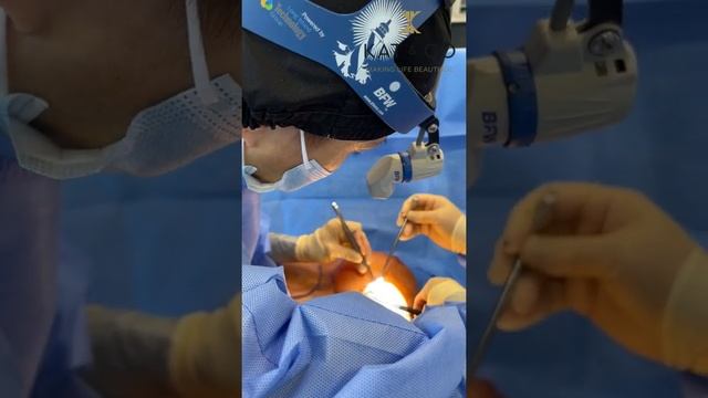 Breast Implant Removal under Local Anaesthetic at Kat and Co смотреть онлайн