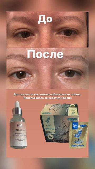 Драйн - выводит лишнюю жидкость из организма,снимает отёк,помогает похудеть! Для заказа 89998447215