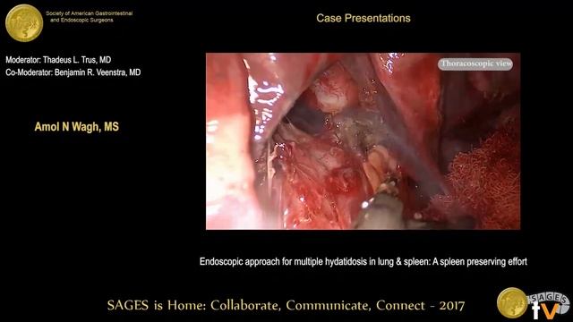 Endoscopic approach for multiple hydatidosis in lung & spleen: A spleen preserving effort смотреть онлайн