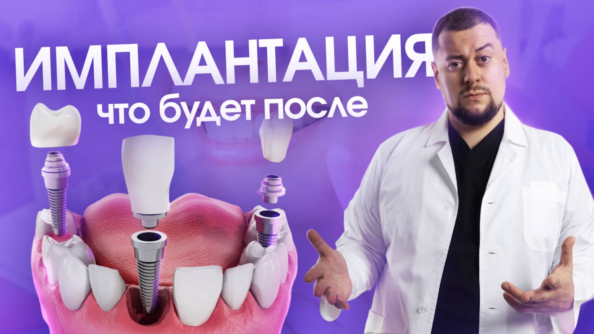 Что будет после имплантации?