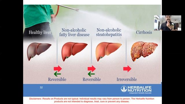 Fatty Liver & Obesity (Telugu) смотреть онлайн
