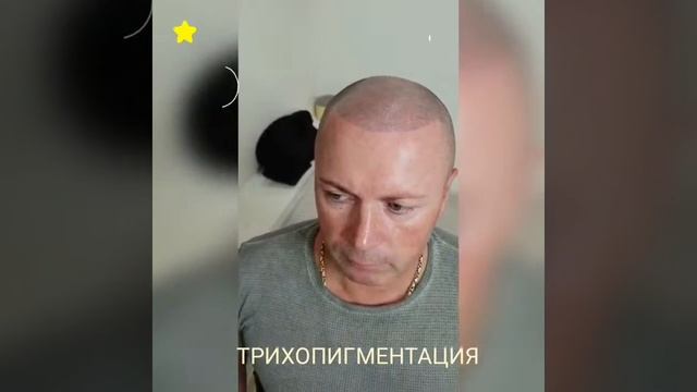 ТРИХОПИГМЕНТАЦИЯ Алена "Колибри" смотреть онлайн