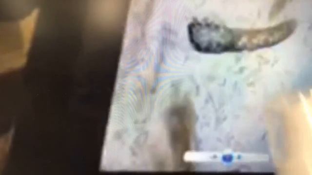 More about Demodex mite смотреть онлайн
